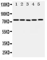 ABCG1 Antibody in Western Blot (WB)