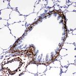 Collagen I Antibody in Immunohistochemistry (Paraffin) (IHC (P))