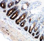 NKCC1 Antibody in Immunohistochemistry (IHC)