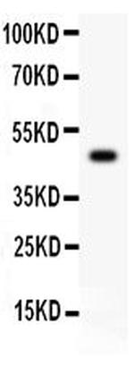 CD45 Antibody in Western Blot (WB)