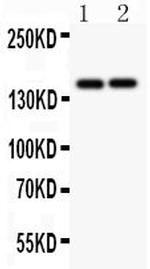 CD45 Antibody in Western Blot (WB)