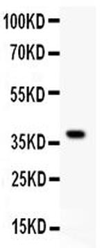 GluR1 Antibody in Western Blot (WB)