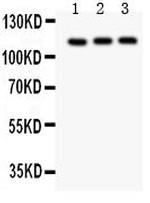 TRPC5 Antibody in Western Blot (WB)