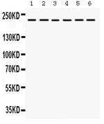 ITGA4 Antibody in Western Blot (WB)