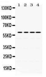 Cdc25C Antibody in Western Blot (WB)