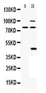 PCSK6 Antibody in Western Blot (WB)