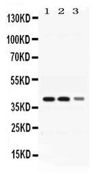 ADH4 Antibody in Western Blot (WB)
