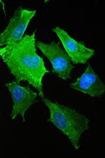 S100A10 Antibody in Immunocytochemistry (ICC/IF)