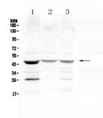 SFTPB Antibody in Western Blot (WB)