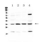 STUB1 Antibody in Western Blot (WB)