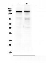 Thrombospondin 2 Antibody in Western Blot (WB)