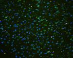 TPR Antibody in Immunohistochemistry (Paraffin) (IHC (P))