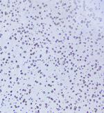 TPR Antibody in Immunohistochemistry (Paraffin) (IHC (P))