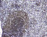 TPR Antibody in Immunohistochemistry (Paraffin) (IHC (P))