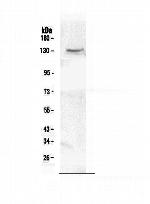 CACNA2D2 Antibody in Western Blot (WB)