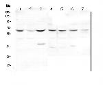 DOK7 Antibody in Western Blot (WB)