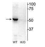 CHRNB2 Antibody in Western Blot (WB)