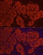 STAR Antibody in Immunocytochemistry (ICC/IF)