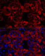 STAR Antibody in Immunohistochemistry (Paraffin) (IHC (P))