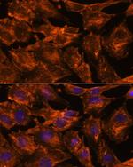 ITSN2 Antibody in Immunocytochemistry (ICC/IF)