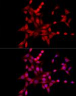 XBP1 Antibody in Immunocytochemistry (ICC/IF)