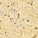 BIN1 Antibody in Immunohistochemistry (Paraffin) (IHC (P))