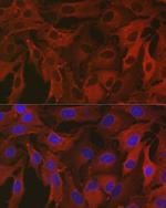 ALDH1A1 Antibody in Immunocytochemistry (ICC/IF)