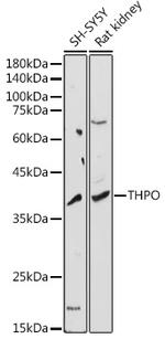 Thrombopoietin Antibody in Western Blot (WB)