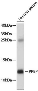 PPBP Antibody in Western Blot (WB)