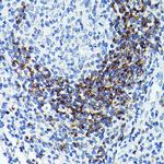 CD79b Antibody in Immunohistochemistry (Paraffin) (IHC (P))