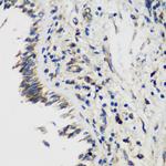 SMYD1 Antibody in Immunohistochemistry (Paraffin) (IHC (P))