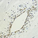 H3K36me2 Antibody in Immunohistochemistry (Paraffin) (IHC (P))