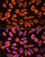 RPS3 Antibody in Immunocytochemistry (ICC/IF)