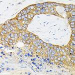 RPS3 Antibody in Immunohistochemistry (Paraffin) (IHC (P))