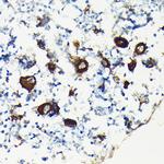 CD61 Antibody in Immunohistochemistry (Paraffin) (IHC (P))