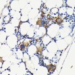 CD61 Antibody in Immunohistochemistry (Paraffin) (IHC (P))