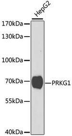 cGKI Antibody in Western Blot (WB)