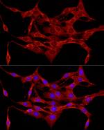 Protein APC Antibody in Immunocytochemistry (ICC/IF)