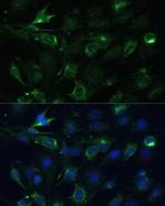 COX6A1 Antibody in Immunocytochemistry (ICC/IF)