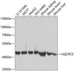 UQCRC2 Antibody in Western Blot (WB)