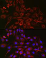 P4HA2 Antibody in Immunocytochemistry (ICC/IF)