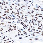 SF3A3 Antibody in Immunohistochemistry (Paraffin) (IHC (P))