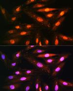 KAP3 Antibody in Immunocytochemistry (ICC/IF)