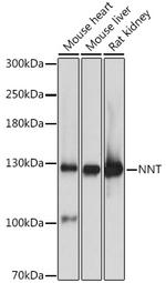 NNT Antibody in Western Blot (WB)