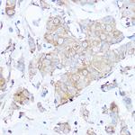 MGP Antibody in Immunohistochemistry (Paraffin) (IHC (P))