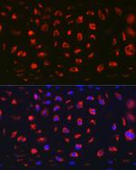 MGP Antibody in Immunohistochemistry (Paraffin) (IHC (P))