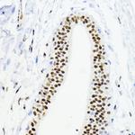 ZEB1 Antibody in Immunohistochemistry (Paraffin) (IHC (P))