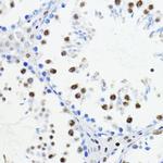 ZEB1 Antibody in Immunohistochemistry (Paraffin) (IHC (P))