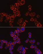 Cathepsin G Antibody in Immunocytochemistry (ICC/IF)