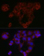 SMAD4 Antibody in Immunocytochemistry (ICC/IF)